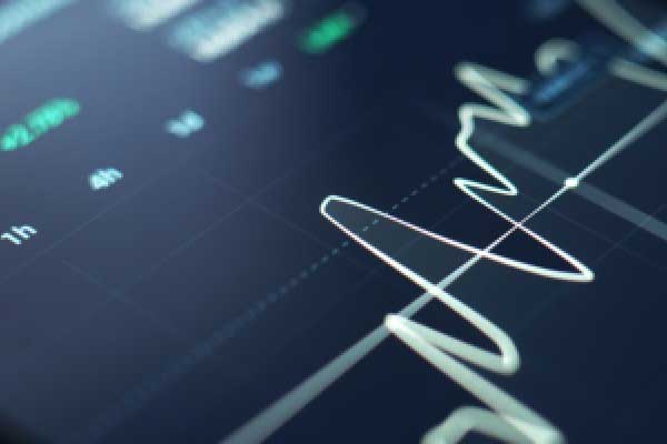 美元对冲成本触及三年低点 人民币乐观情绪升温